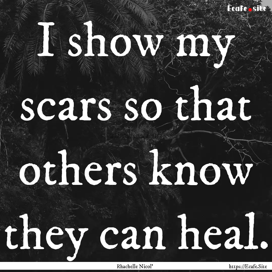 I show my scars so that others know they.... : Quote by Rhachelle Nicol'