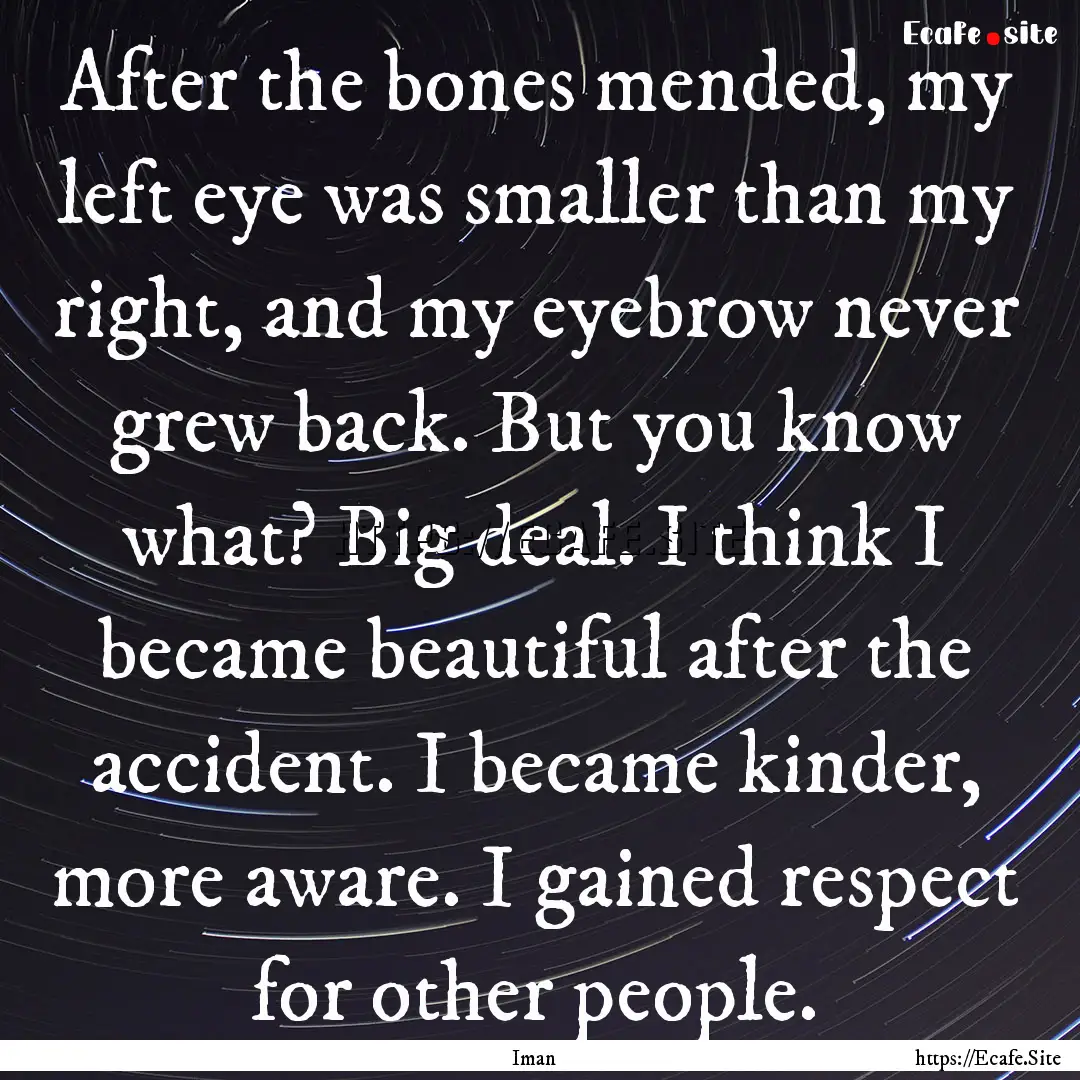 After the bones mended, my left eye was smaller.... : Quote by Iman